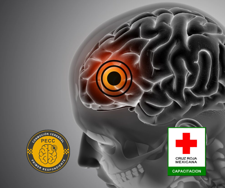 Programa de Emergencias en Conmoción Cerebral (PECC)