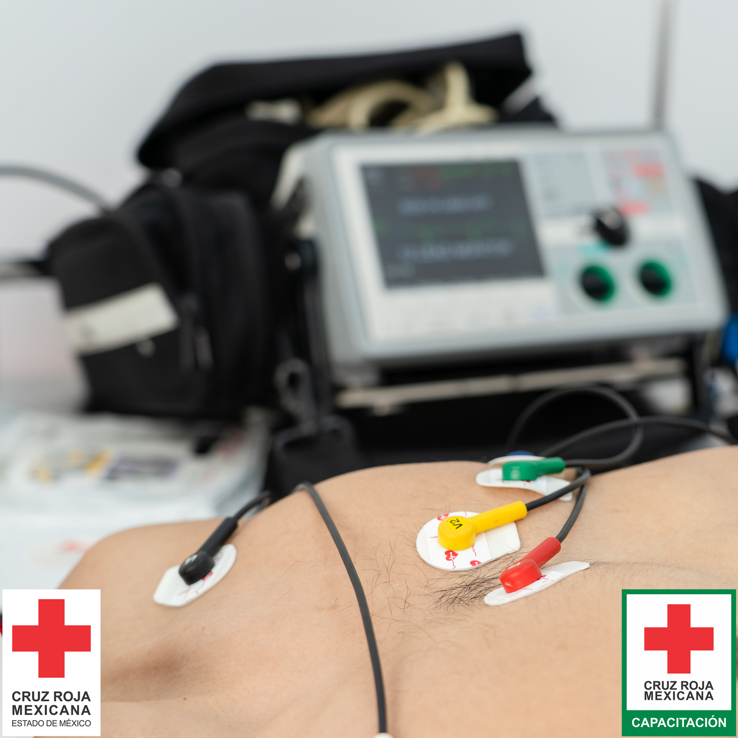 Electrocardiografía Básica