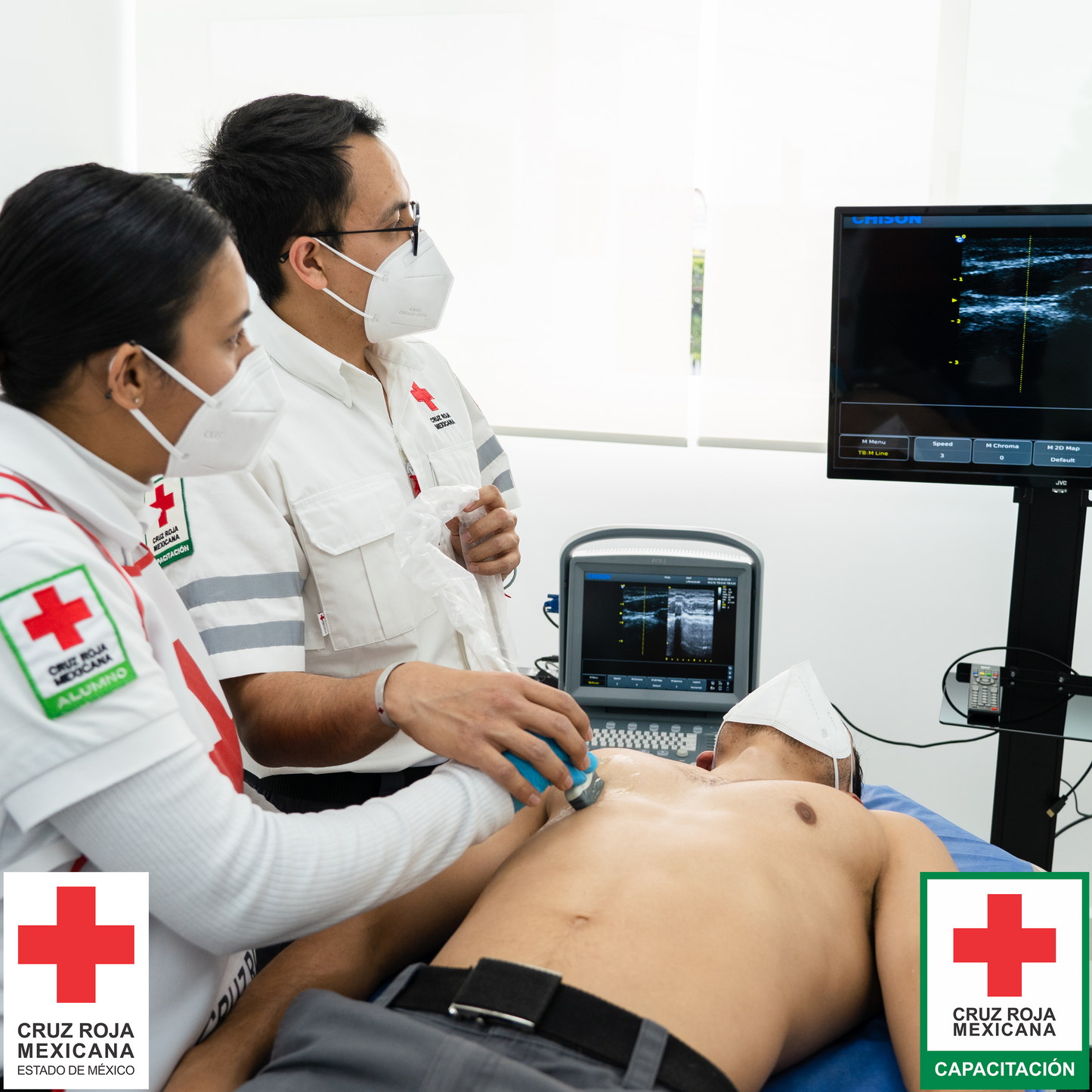 Accesos Vasculares Ecoguiados